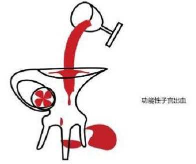 胚胎移植-北京助孕试管婴儿中胚胎移植技术的神奇