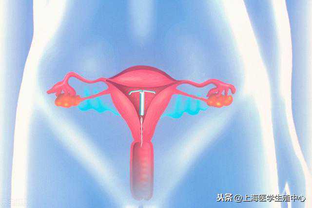 试管科普之女性输卵管堵塞还能做试管婴儿吗？