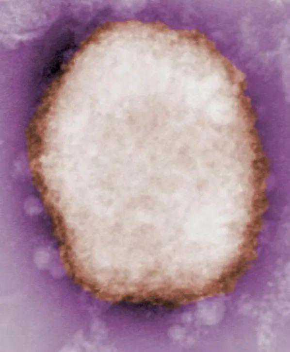 多国报告人类感染猴痘病例，这 6 个问题你需要知道